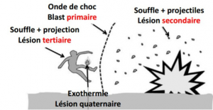 Les 5 niveaux de lésions physiologiques dues aux explosions.