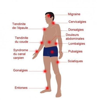 Zones du corps exposées aux principaux risques des TMS au travail.