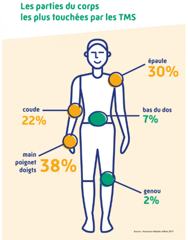 Schéma des zones de douleurs liées aux risques des gestes répétitifs au travail.