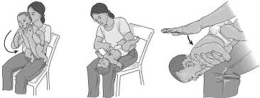 Schéma des gestes de secours SST nourrisson étouffement.